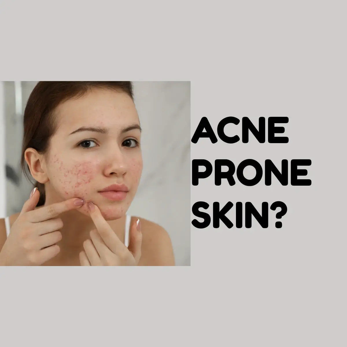 Best Korean skincare solutions for acne-prone skin in UAE