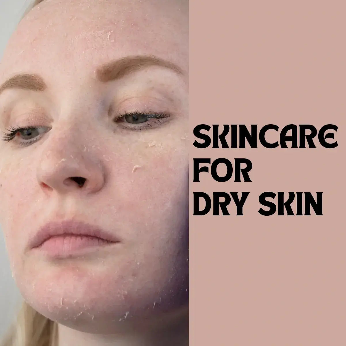 Dry skin care in UAE with Korean skincare routine for deep hydration and repair