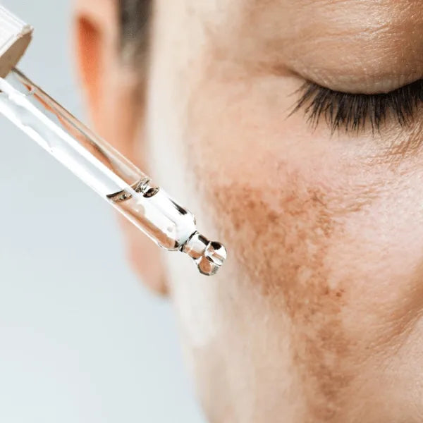 Korean skincare for hyperpigmentation and dark spots in UAE – fade pigmentation and brighten skin naturally