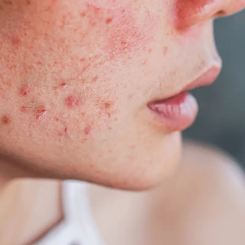 Skin Barrier Repair – Strengthen and Protect Damaged Skin with Korean Skincare in UAE