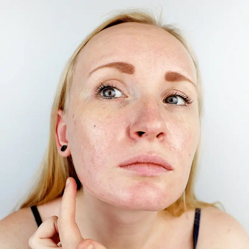 Redness and Rosacea Skincare – Korean Calming and Soothing Products for Sensitive Skin in UAE