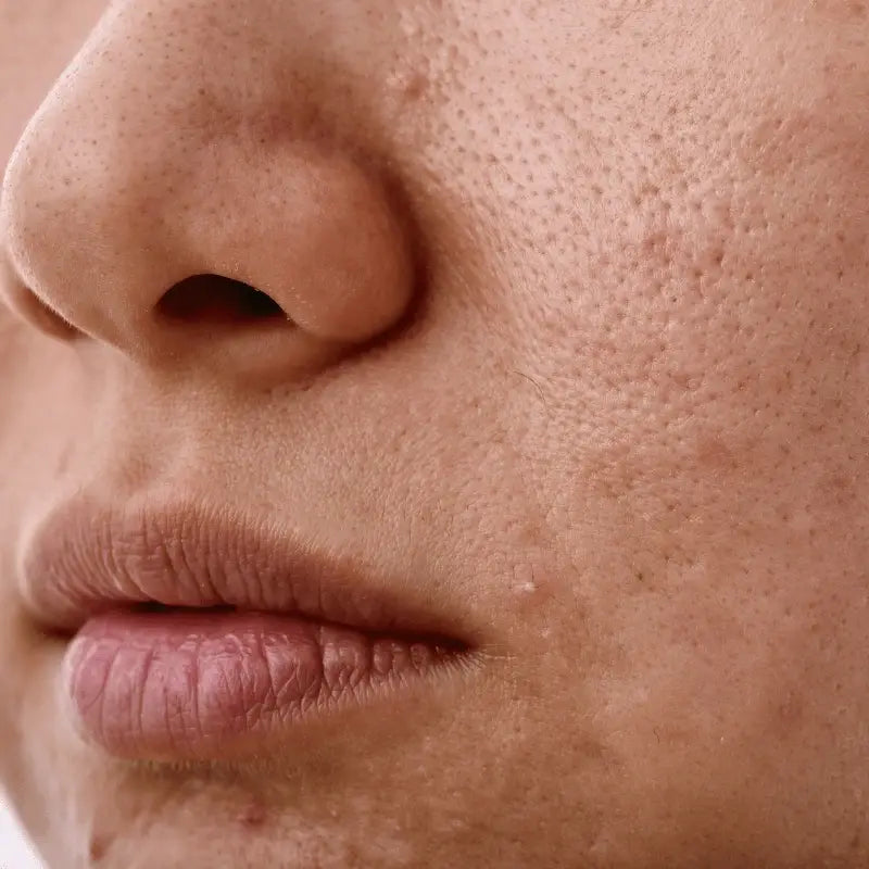 Brightening & Uneven Skin Tone - The Pretty Picks
