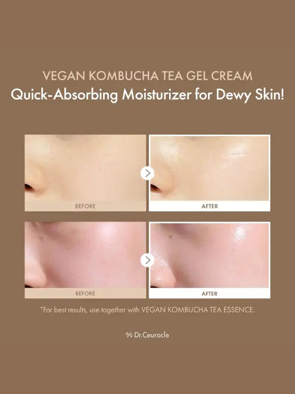 Dr. Ceuracle - Vegan Kombucha Tea Gel Cream - before and after