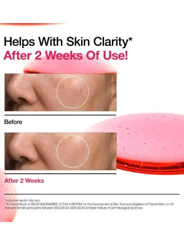 Anua - Niacinamide 10% + TXA 4% Serum - 30 ml Benefits