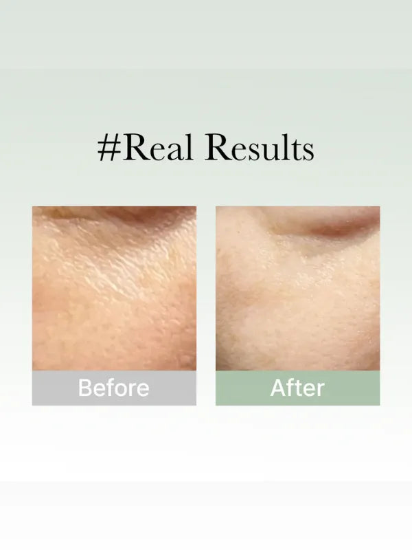 arencia-holy-hyssop-serum-30-50g-before-and-after-comparison