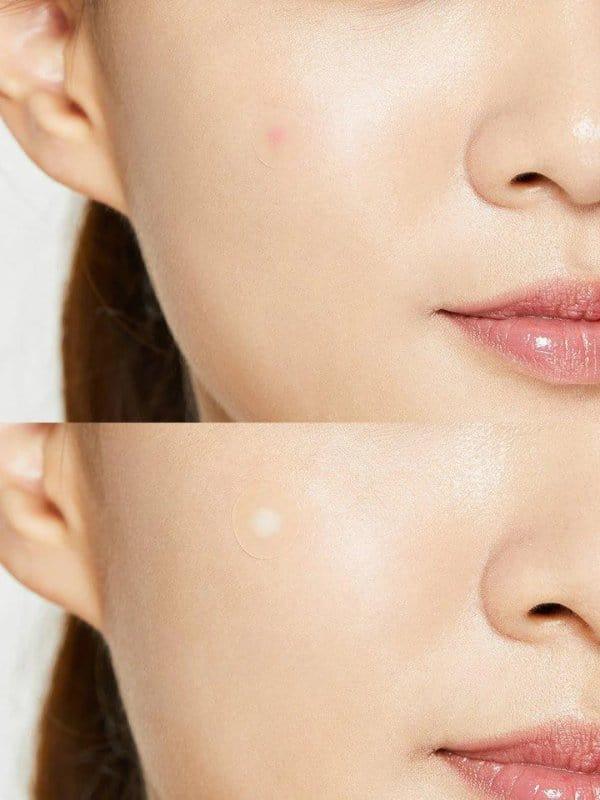 COSRX - Acne Pimple Master Patch 