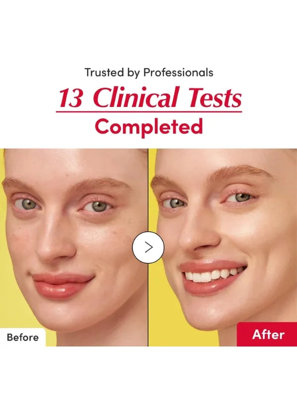 Clinically tested – proven results for improved brightness and reduced pigmentation with regular use