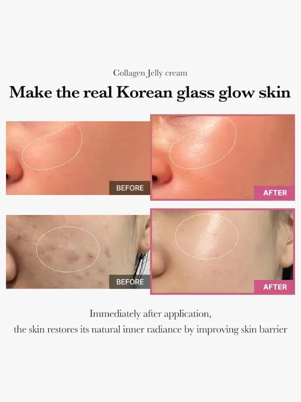 medicube - Collagen Jelly Cream before and after