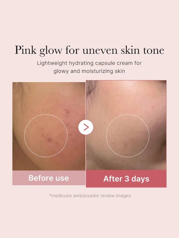 medicube - PDRN Pink Collagen Capsule Cream - 55g  before and after 