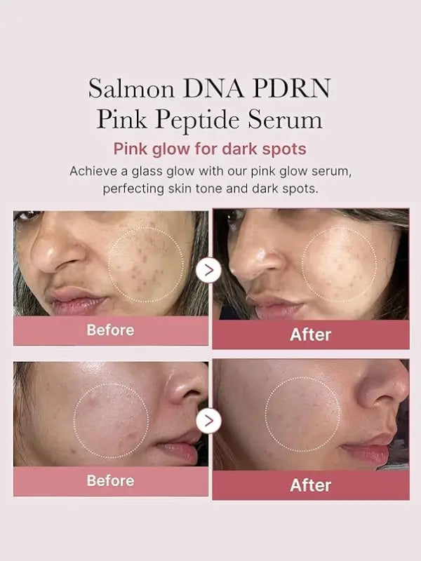 medicube PDRN Pink Peptide Serum before and after